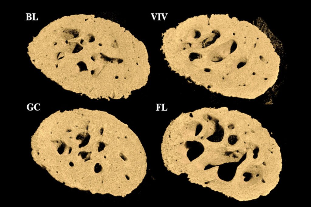 کاهش تراکم استخوان در فضا
