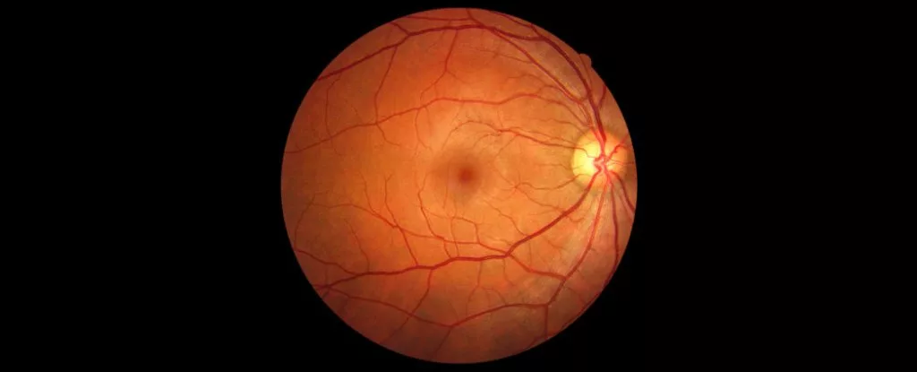 رگ‌های چشم شاید بتواند به تشخیص زودهنگام زوال عقل کمک کند