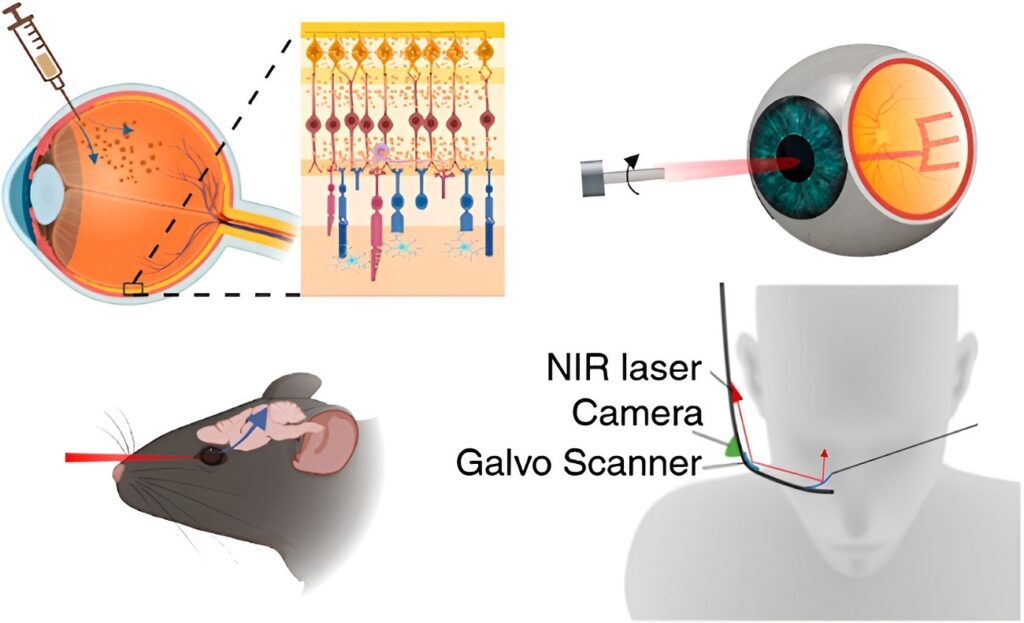 تزریق طلا به چشم برای درمان نابینایی